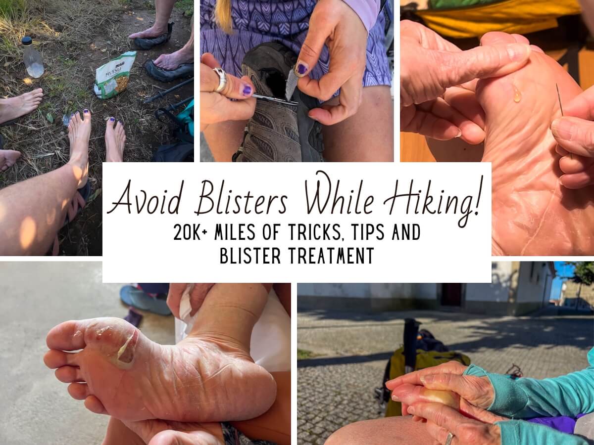 Collage image of blisters and feet to describe how to avoid blisters while hiking.